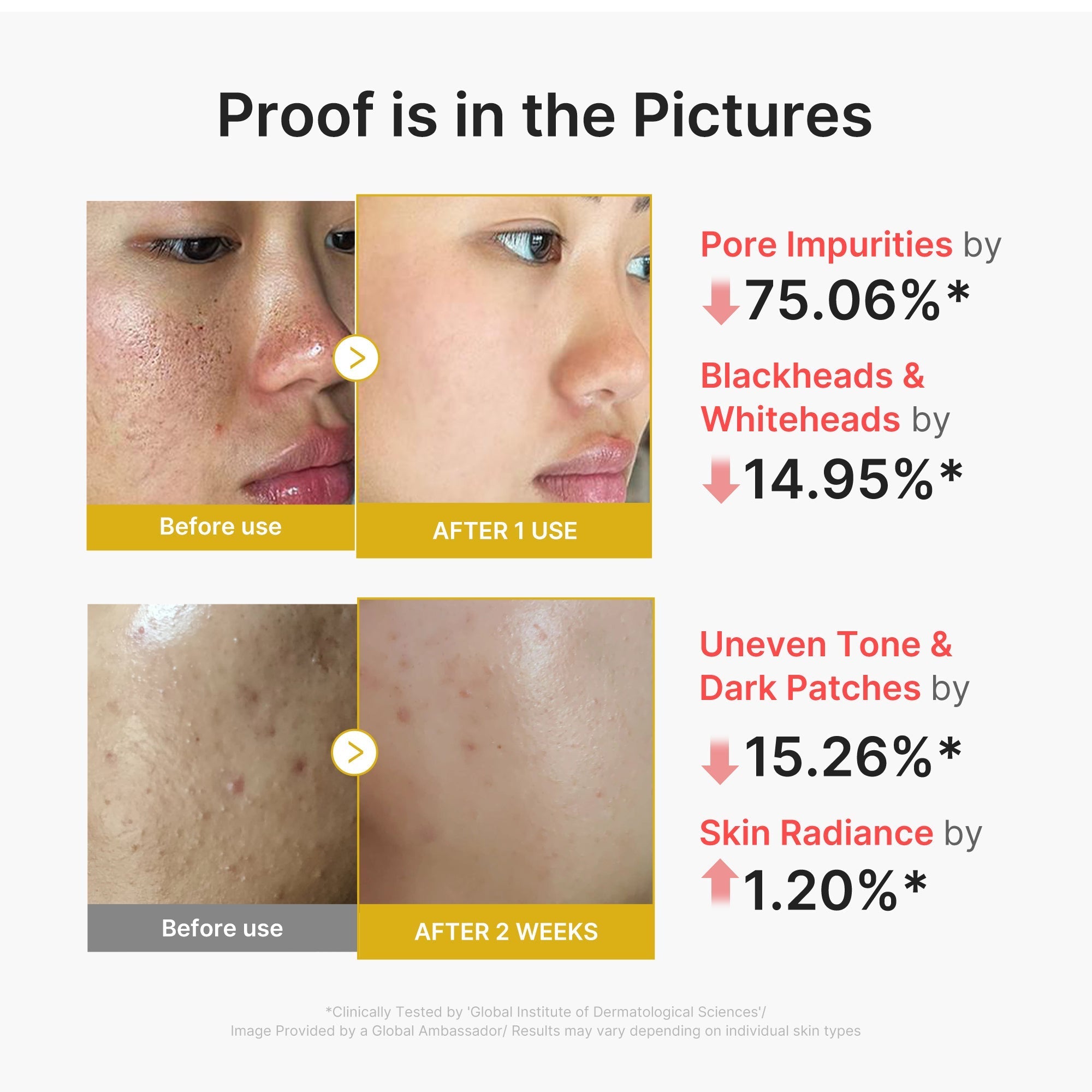 Kojic Acid Turmeric Peel Shot - Fresh Face Routine
