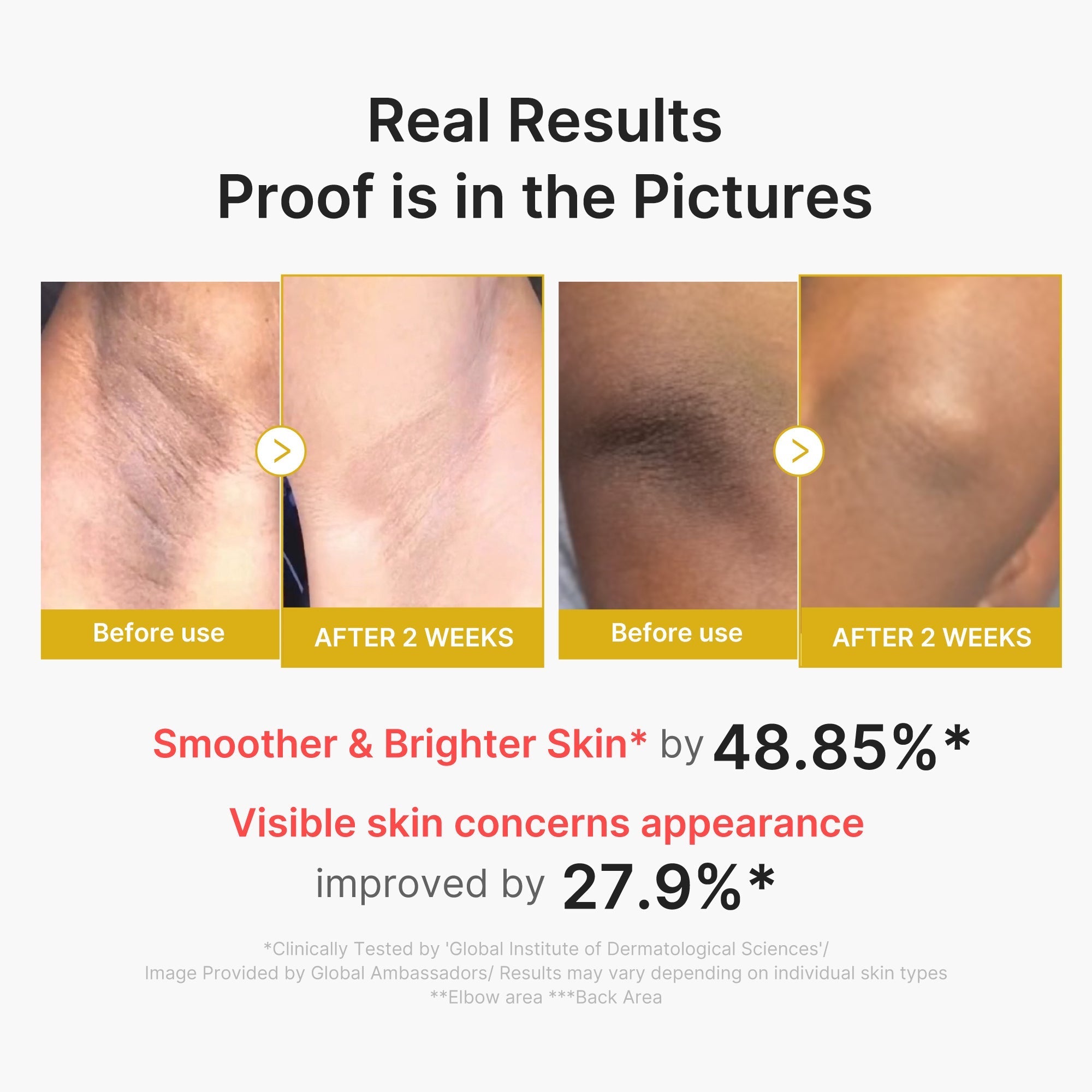 Kojic Acid Turmeric Body Peel Shot - Glow Favorites