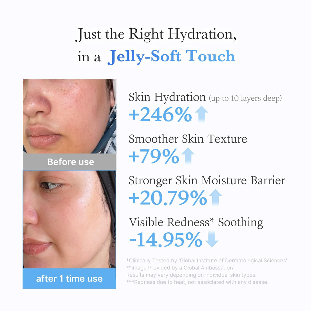 Hyaluronic Ceramide Moisturizing Jelly Cream - Fresh Starts Here