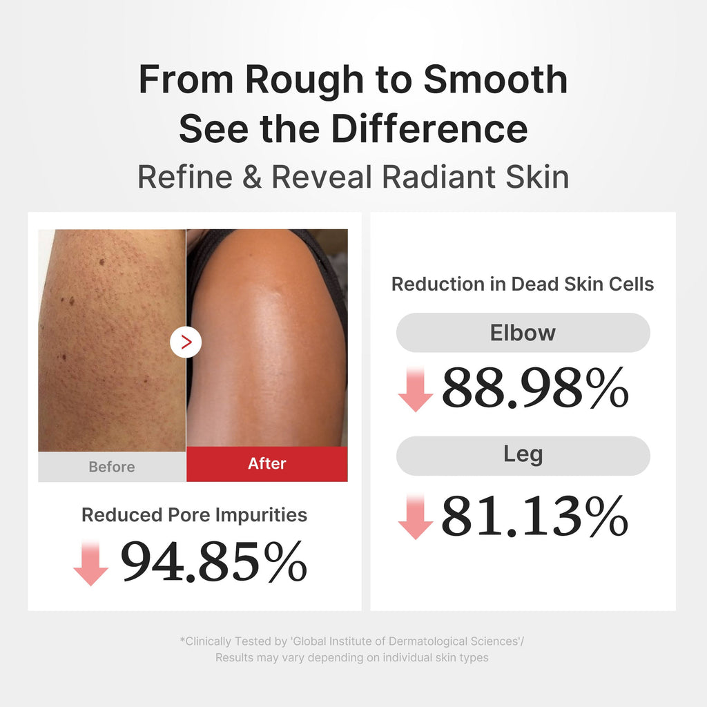 Hypochlorous Acid Rice Body Peel Shot - Ready for Daily Glow