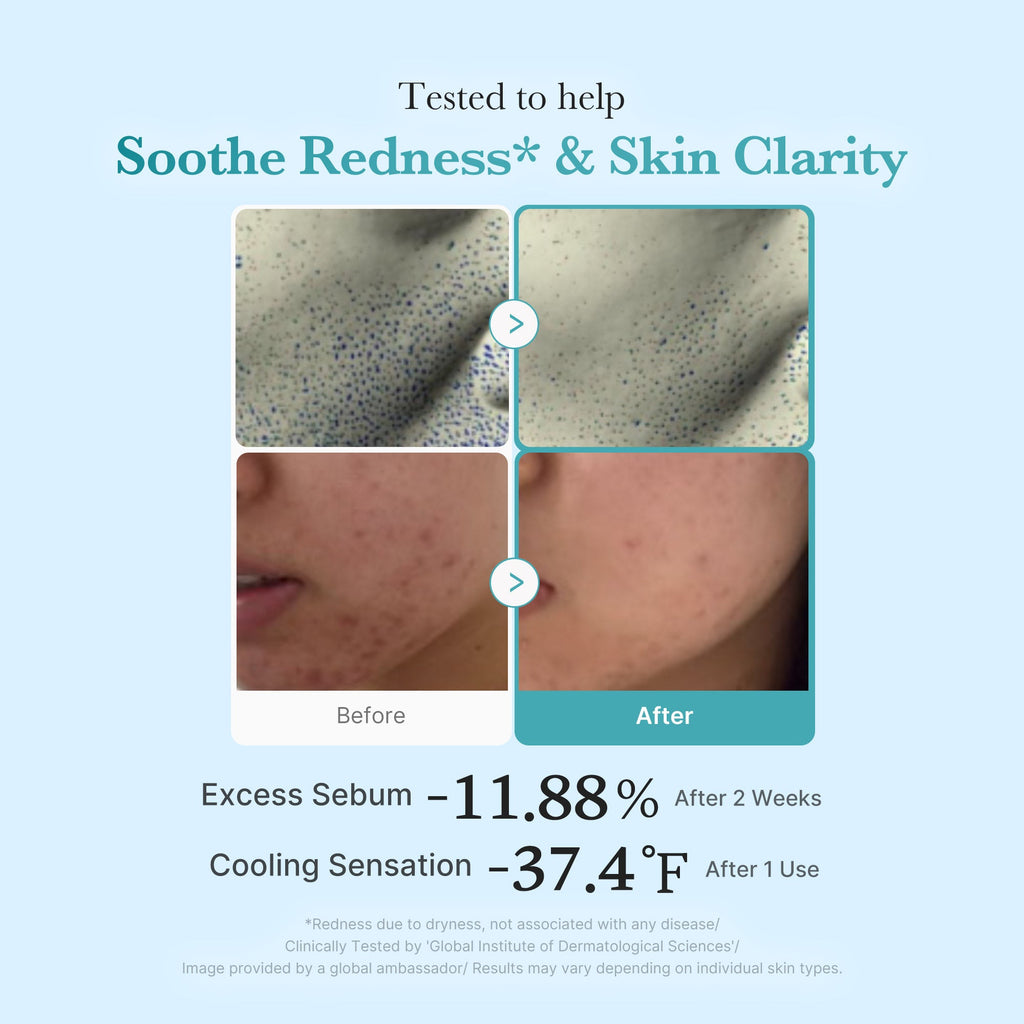 Azelaic Acid Niacinamide Clarifying Toner - Simple Skin Pick