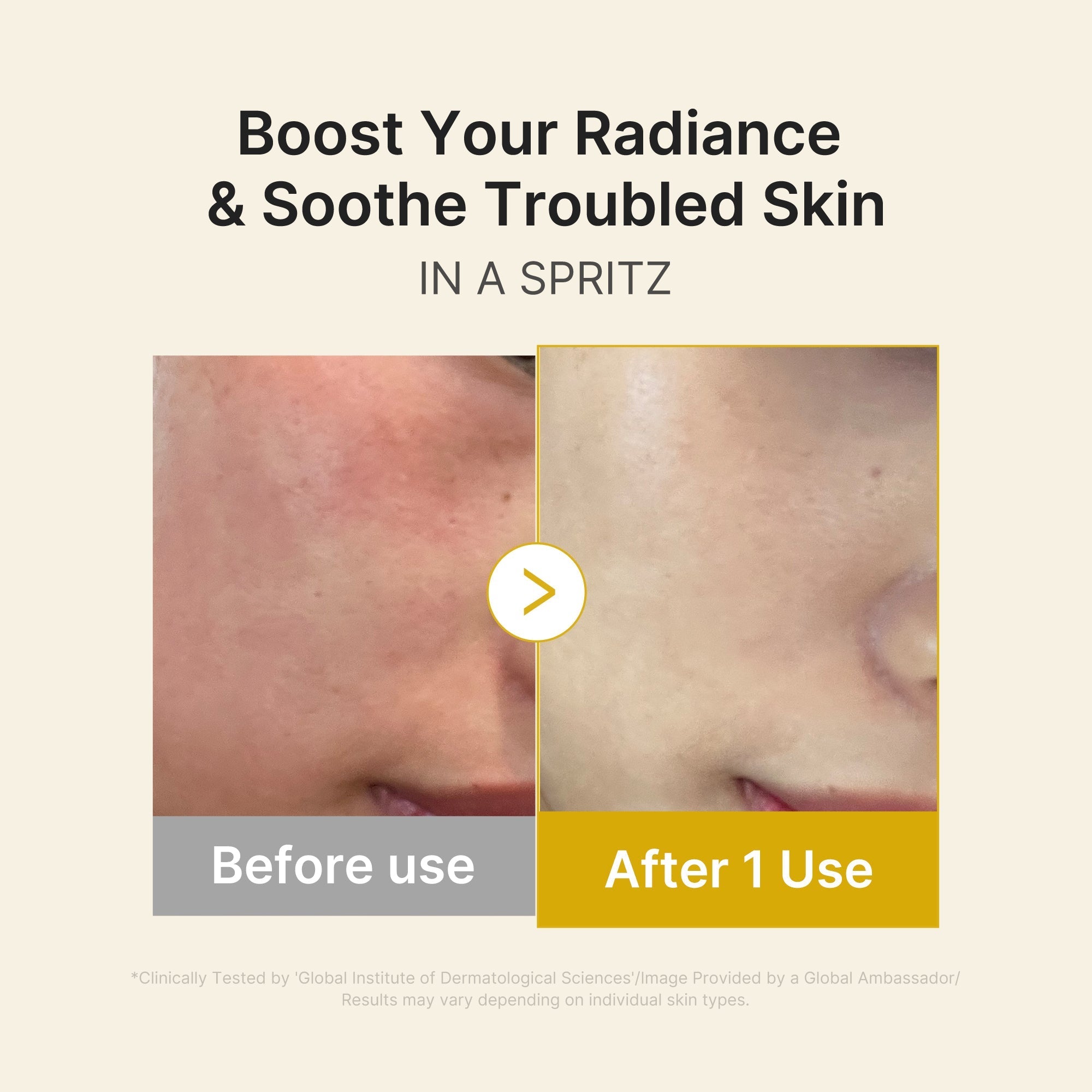 Kojic Acid Turmeric Vitamin Gold Jelly Mist Serum - Daily Face Care