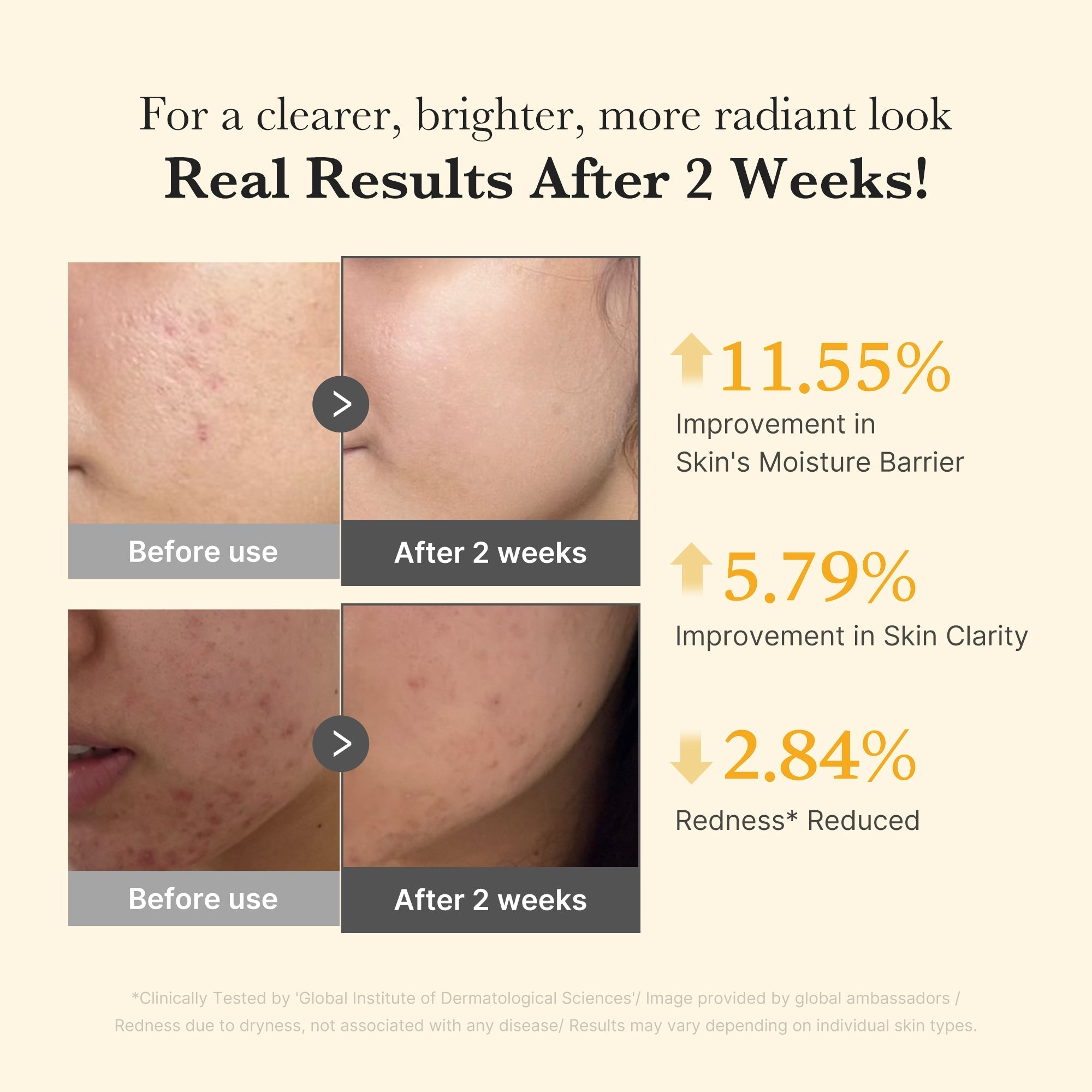 Kojic Acid Turmeric Capsule Serum - Easy Glow Routine