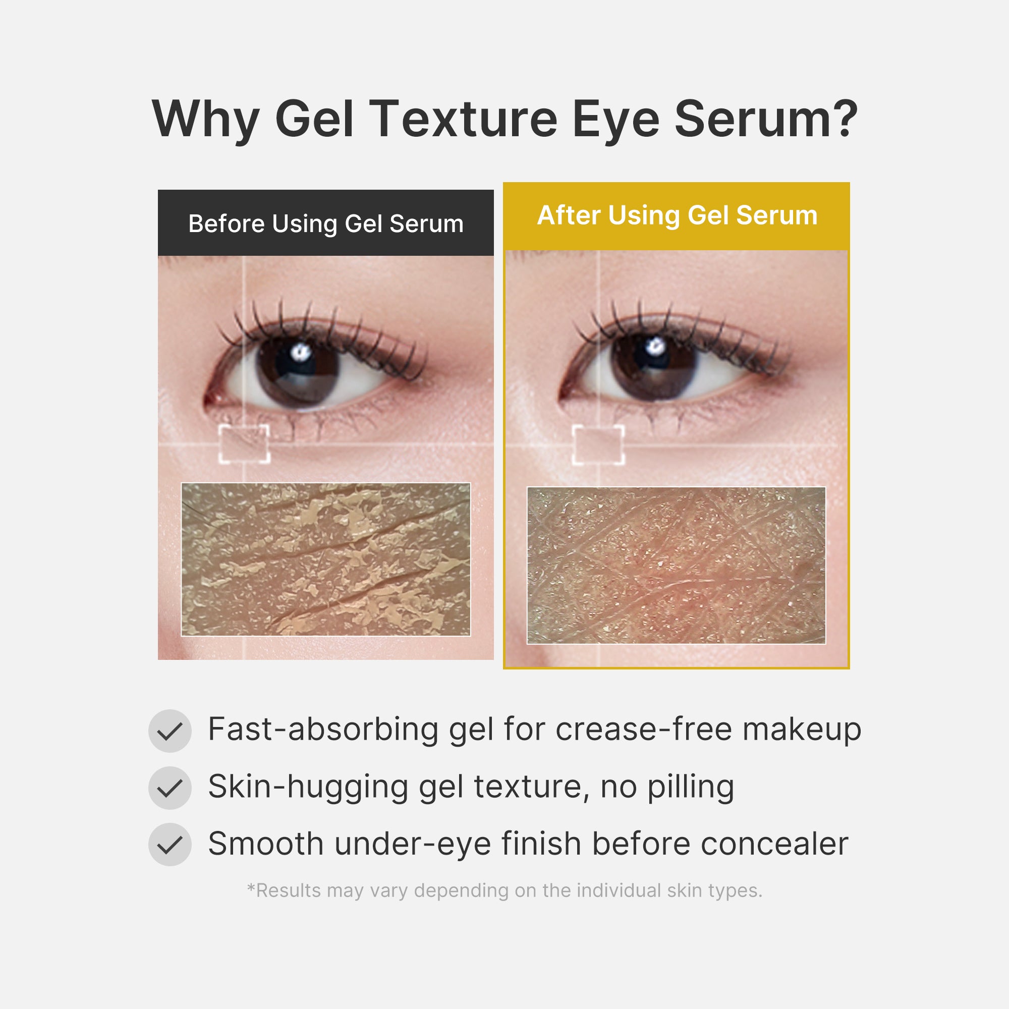 Kojic Acid Tumeric Eye Gel Serum - Daily Skin Essentials