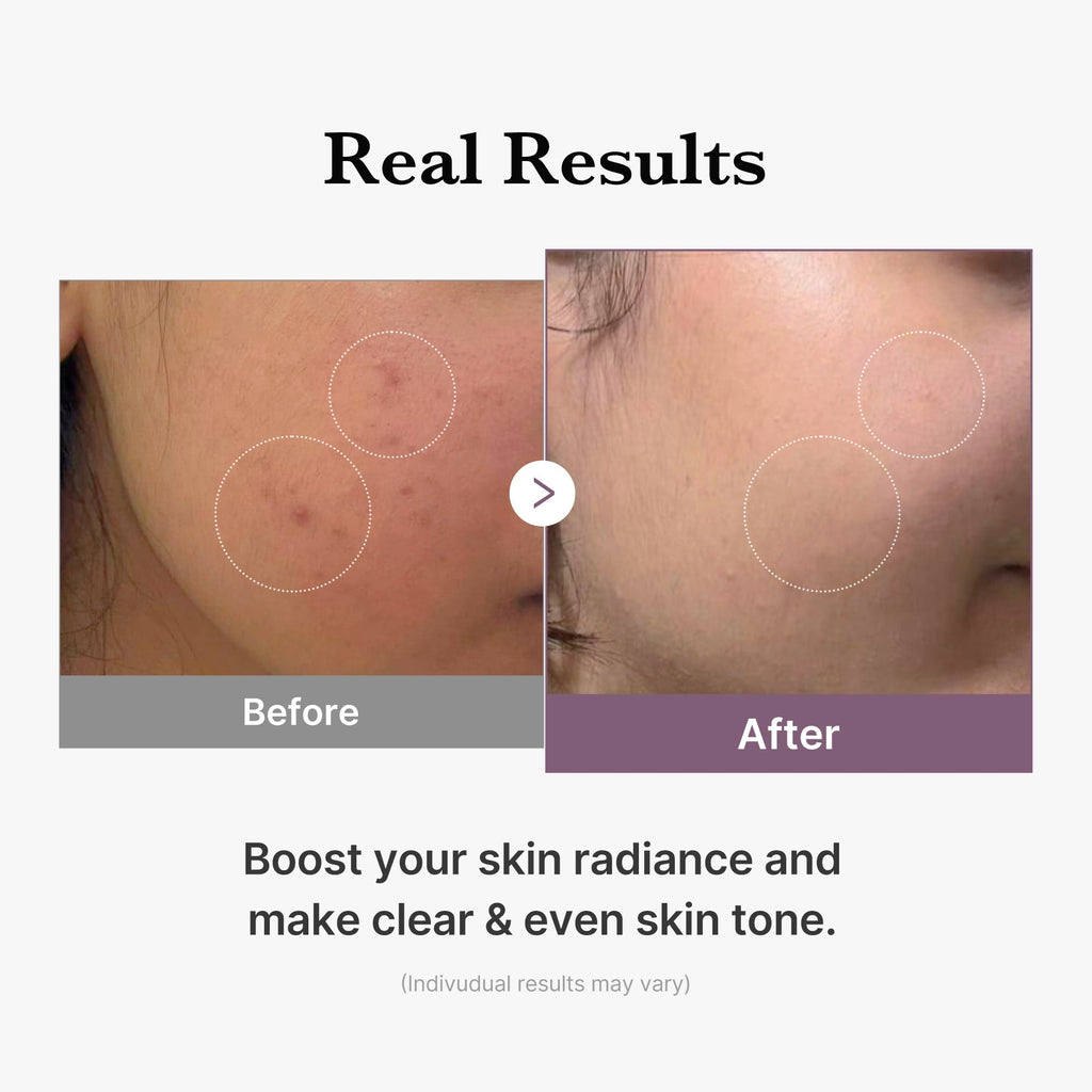AGE-R Glutathione Glow Milk Toner - Fresh Routine Essential