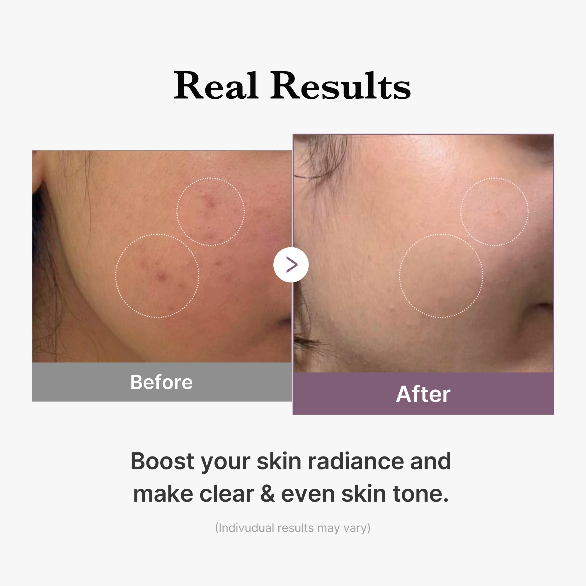 AGE-R Glutathione Glow Milk Toner - Fresh Routine Essential