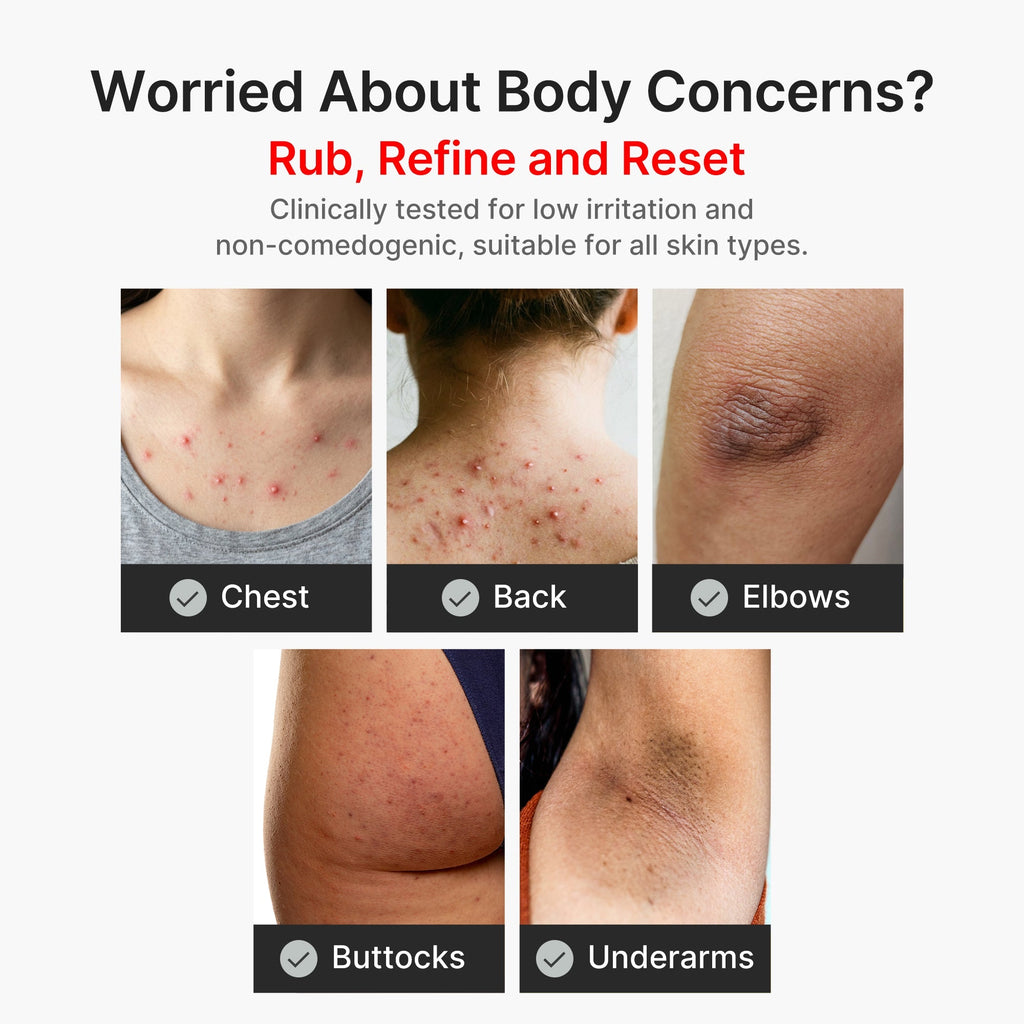 Kojic Acid Turmeric Body Peel Shot - Glow Favorites