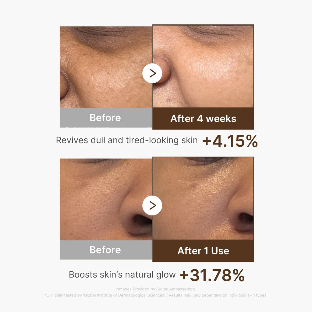 Deep Vitamin C Capsule Serum - Daily Face Routine