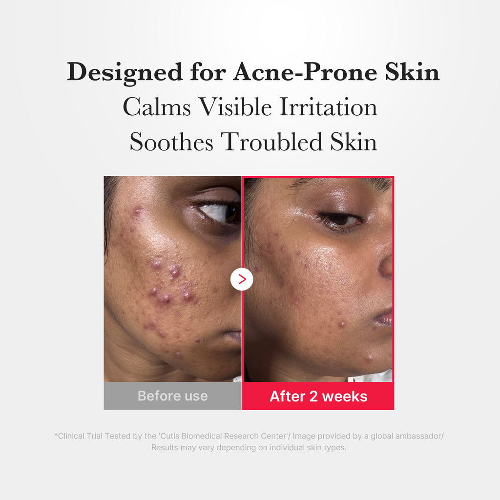 Hypochlorous Acid Power Soothing Spray - Hydrated-Looking Skin