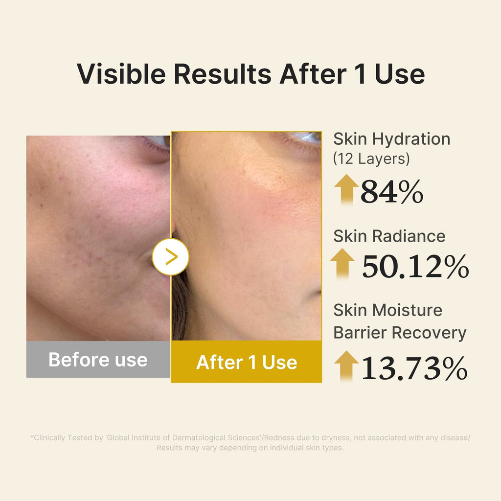 Kojic Acid Turmeric Vitamin Gold Jelly Mist Serum - Daily Face Care