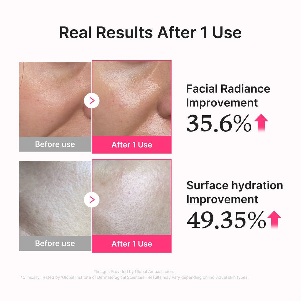 PDRN Pink Collagen Glow Jelly Serum - Soft Glow Look