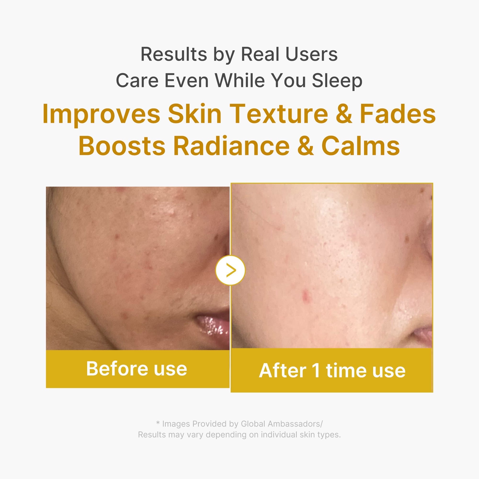 Kojic Acid Turmeric Overnight Wrapping Mask - Fresh Face Daily