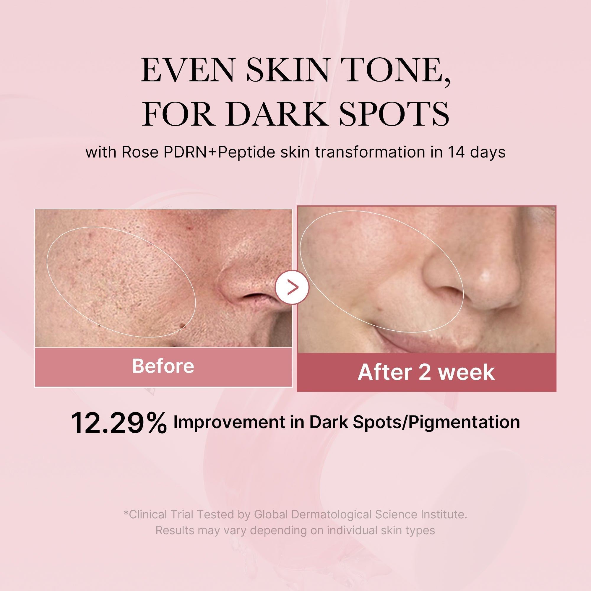 PDRN Pink Peptide Toner - Skin Refresh Daily