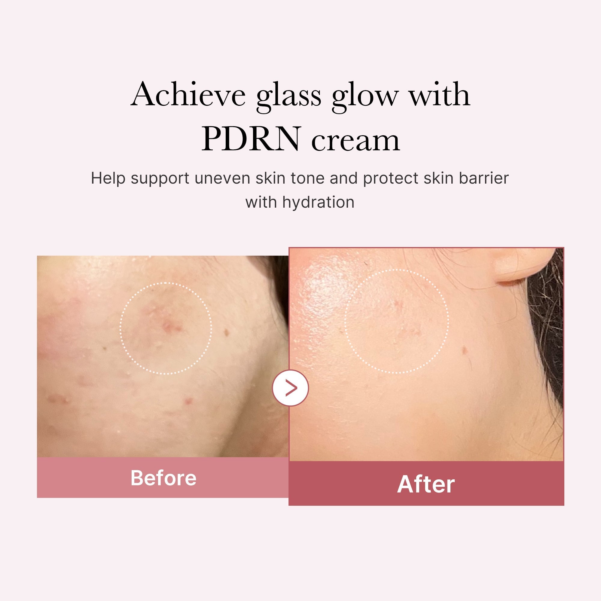 PDRN Pink Peptide Cream - Skincare Favorites