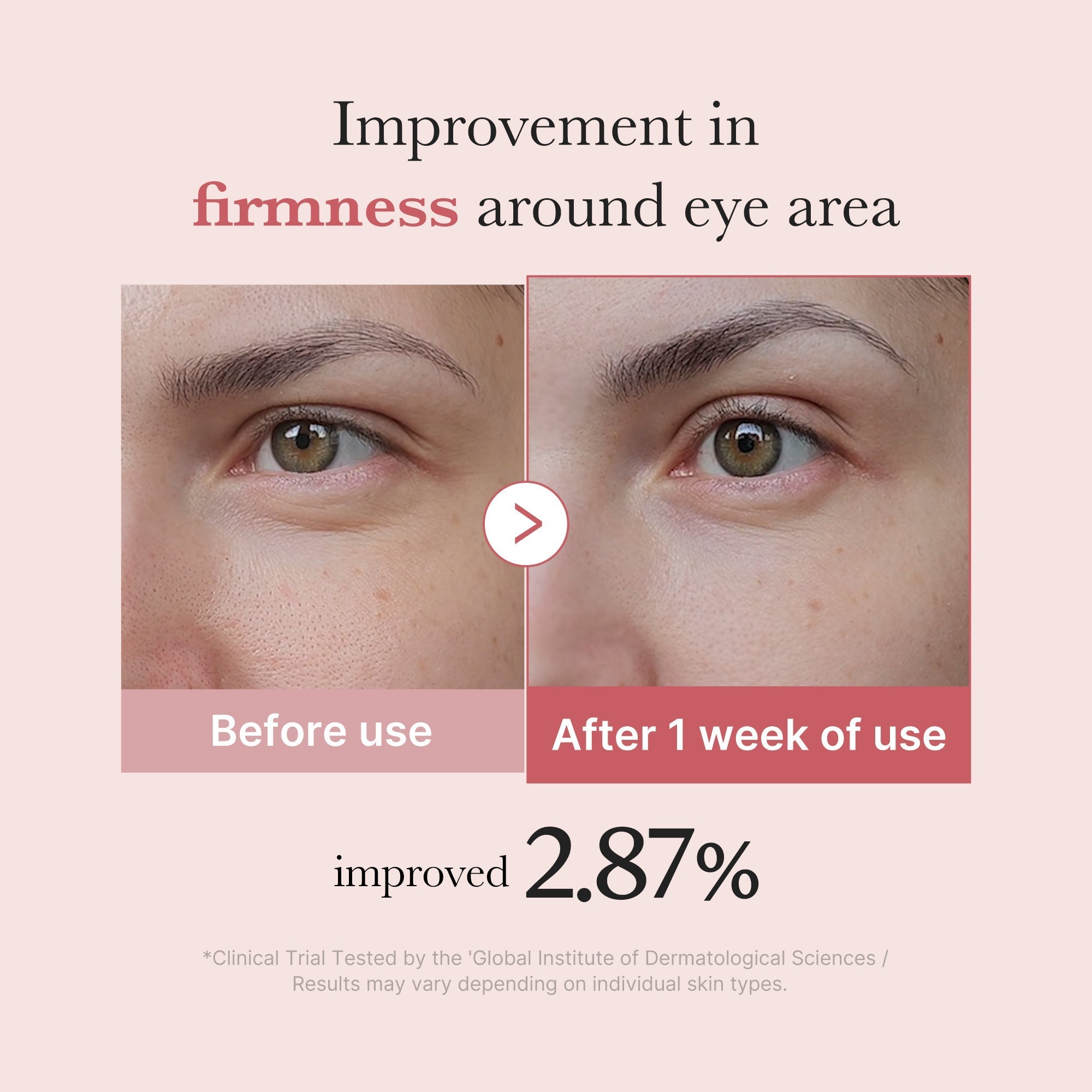 PDRN Pink Peptide Eye Cream - Skincare You’ll Reach For