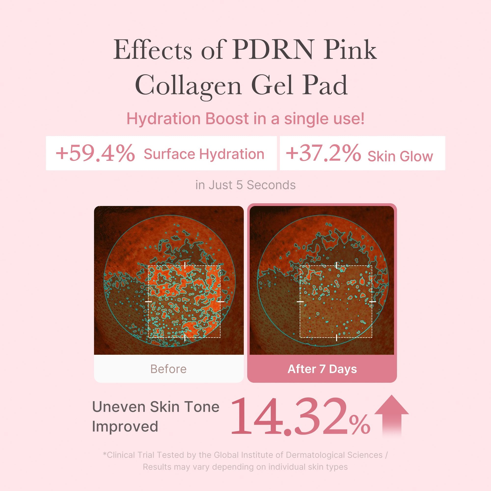 PDRN Pink Collagen Gel Toner Pad - Hydrate and Glow