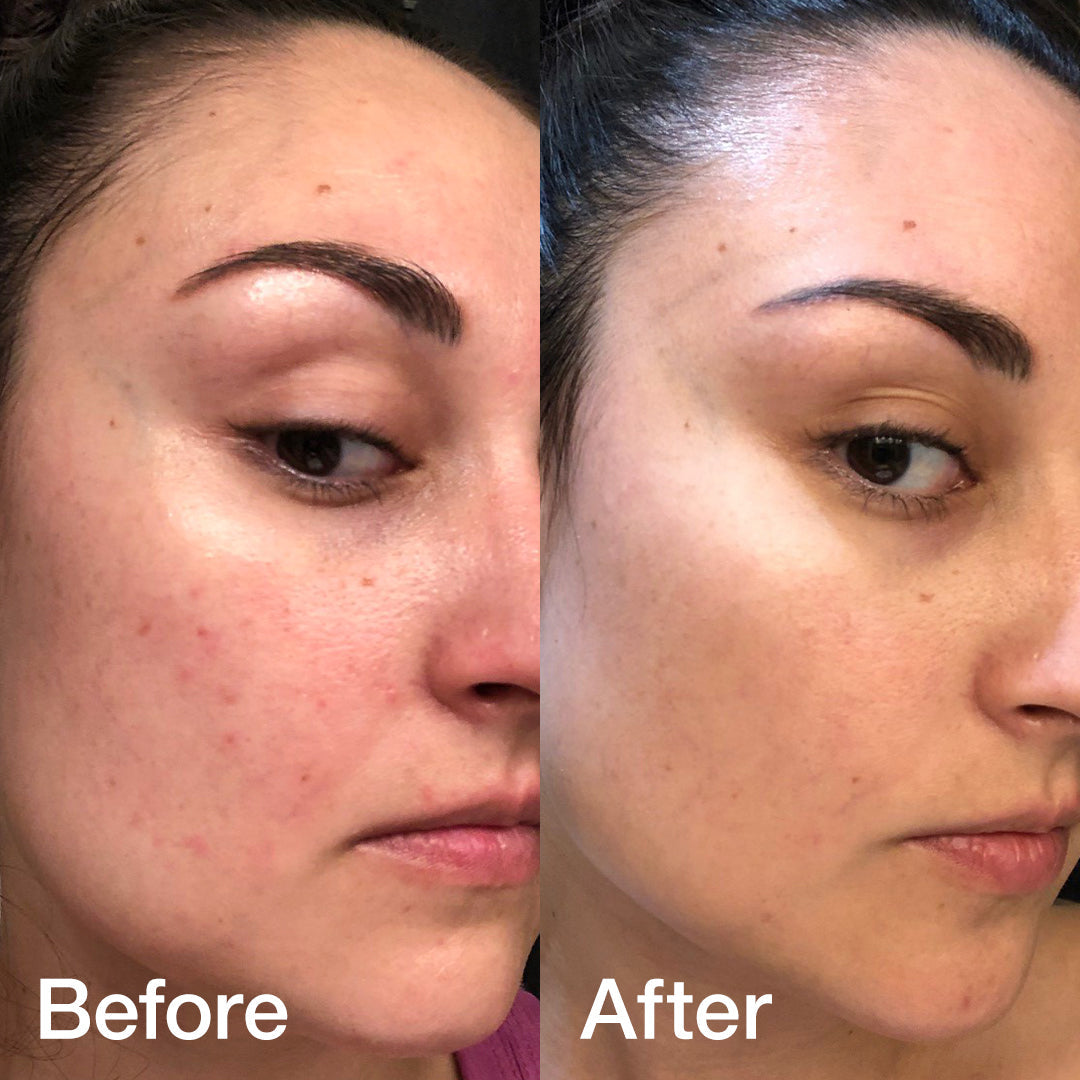 Glass Glow Duo - Fresh Routine Essential