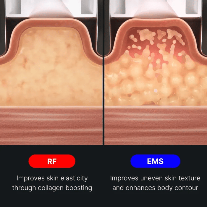 AGE-R Contour Body Shot - Smooth Care Daily